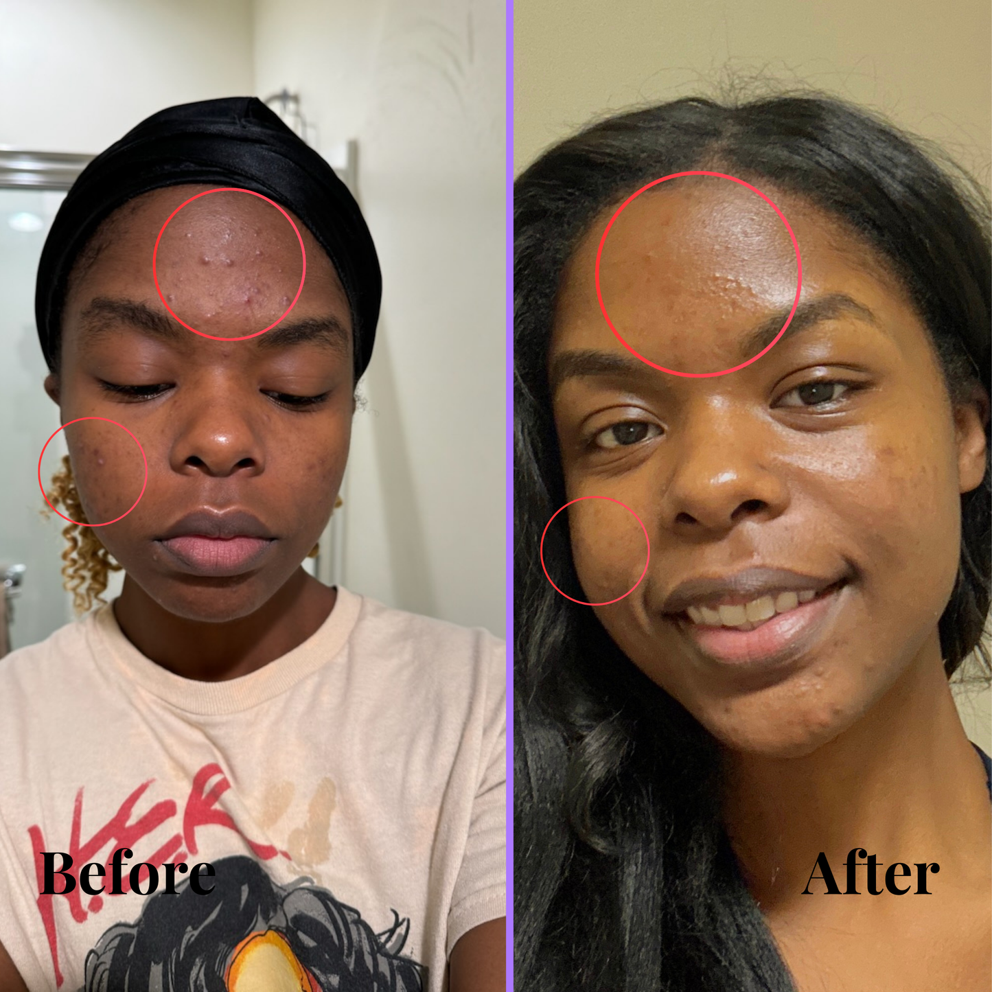 Skin Restoration Serum