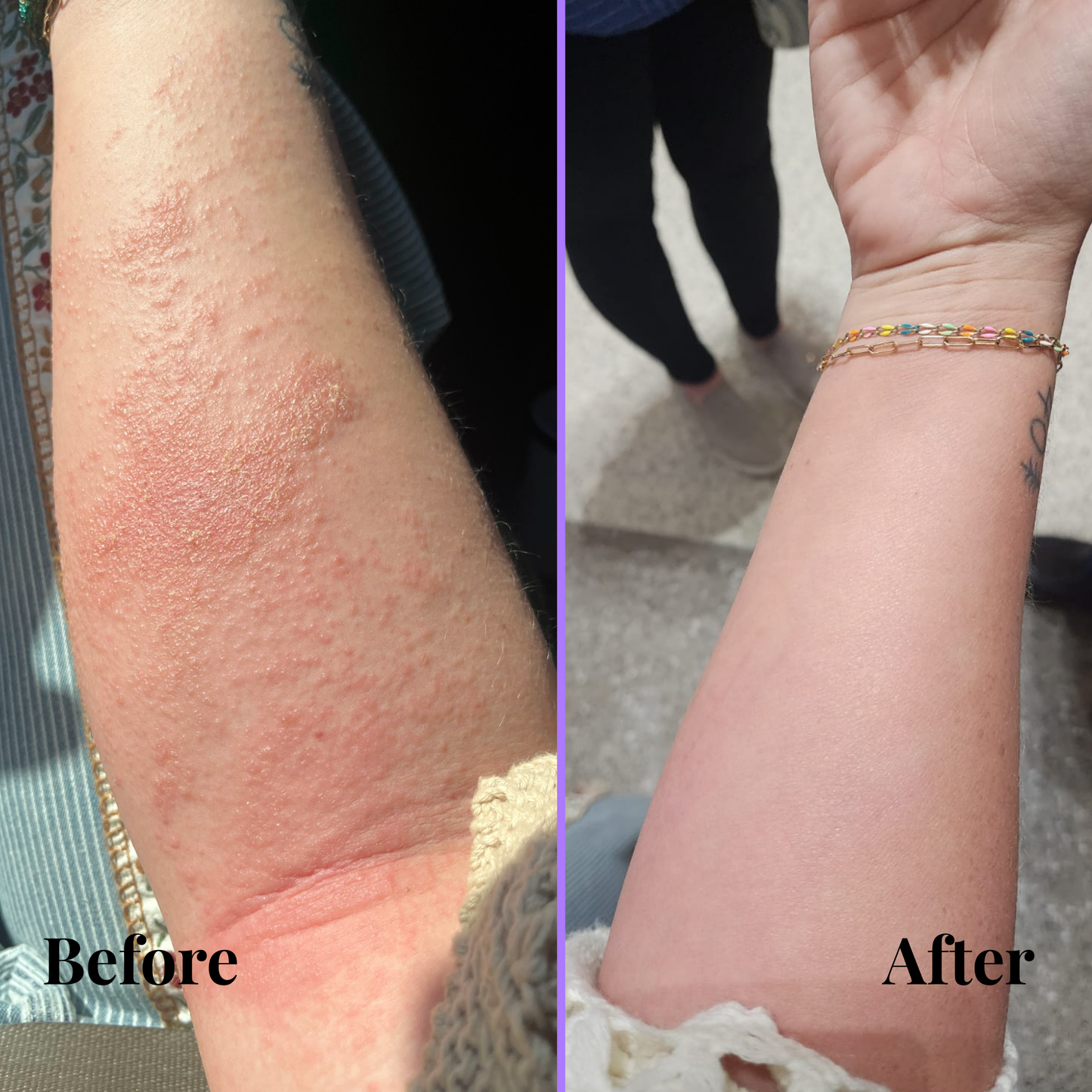 Skin Restoration Serum