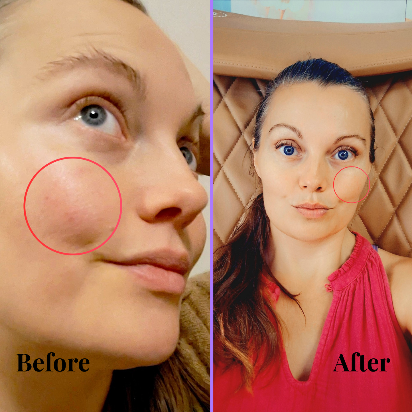 Skin Restoration Serum