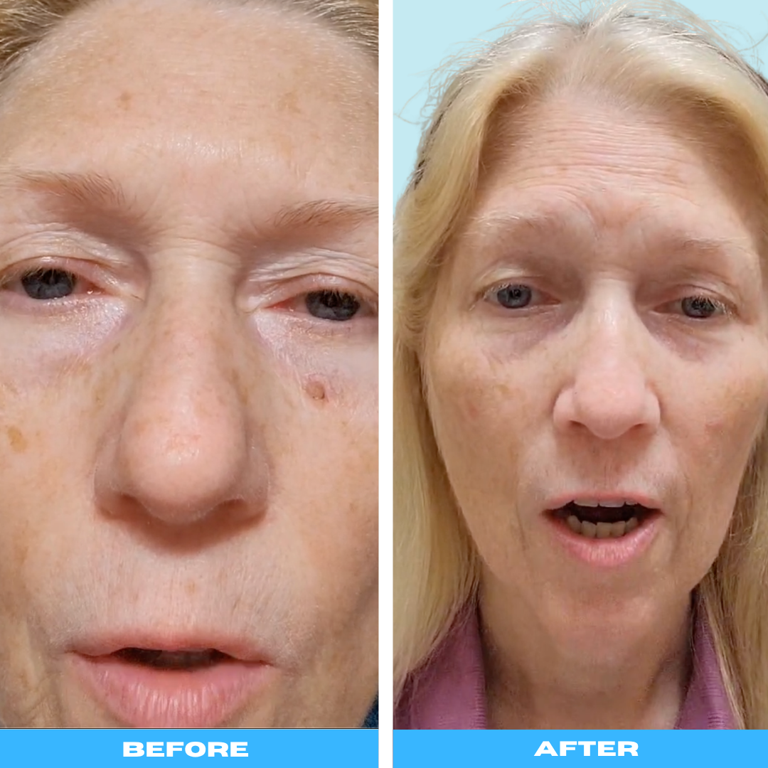 Skin Restoration Serum